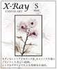 X RAY キャンバスアート ウィンドミル.|s1